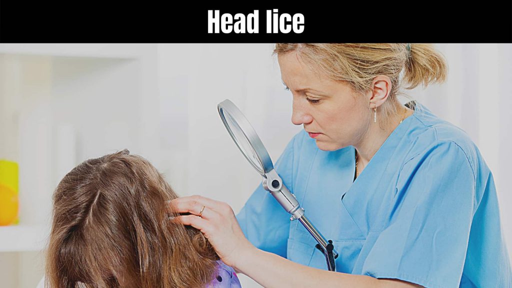 How to check yourself for lice